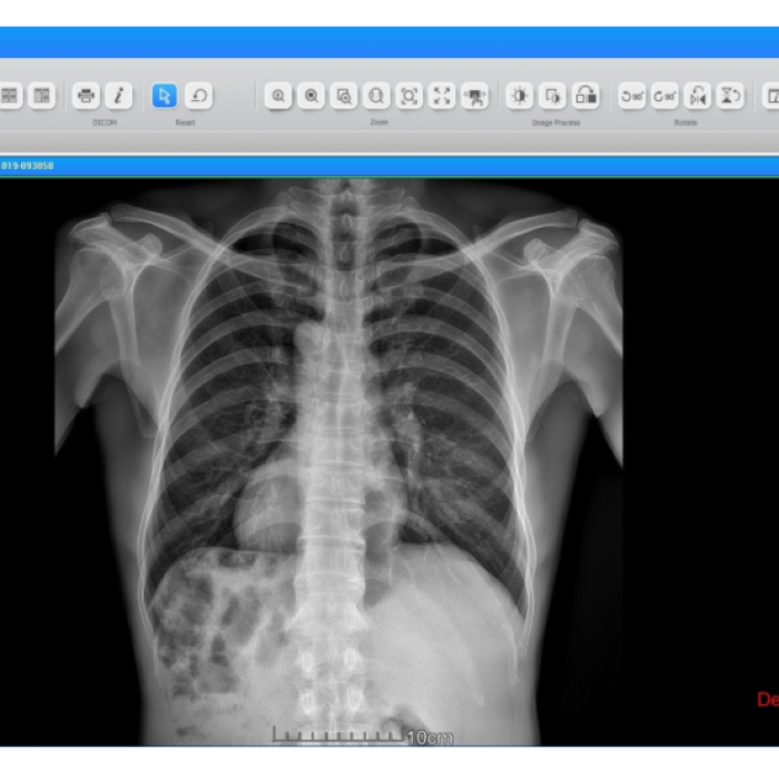 tile-examvue-pacs-1-1030x683