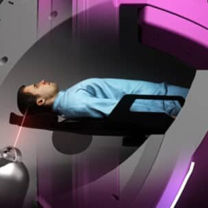 zap-design-advantage-minimal-radiation-scatter-560x300